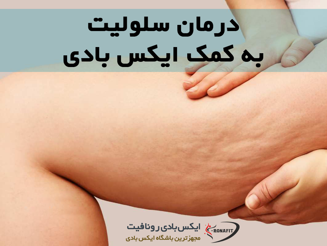 درمان سلولیت ایکس بادی